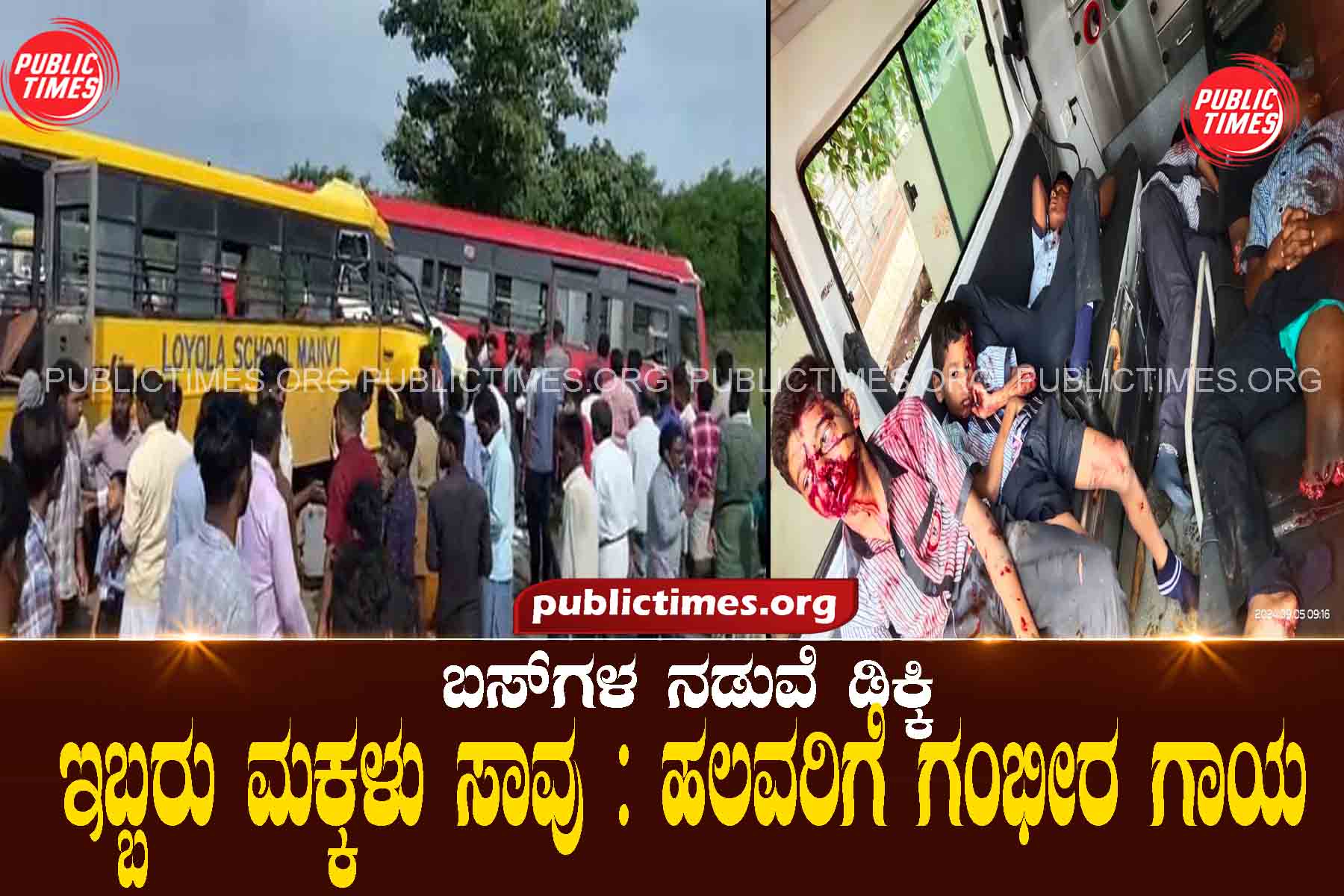 Collision between buses: Two children killed: Many seriously injured ಬಸ್‌ಗಳ ನಡುವೆ ಡಿಕ್ಕಿ : ಇಬ್ಬರು ಮಕ್ಕಳು ಸಾವು : ಹಲವರಿಗೆ ಗಂಭೀರ ಗಾಯ