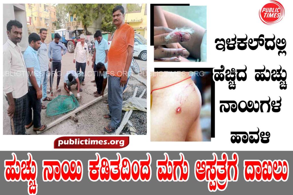 ILKAL  Kid bitten by mad dog admitted to hospital ಹುಚ್ಚು ನಾಯಿ ಕಡಿತ ಮಗು ಆಸ್ಪತ್ರೆಗೆ ದಾಖಲು