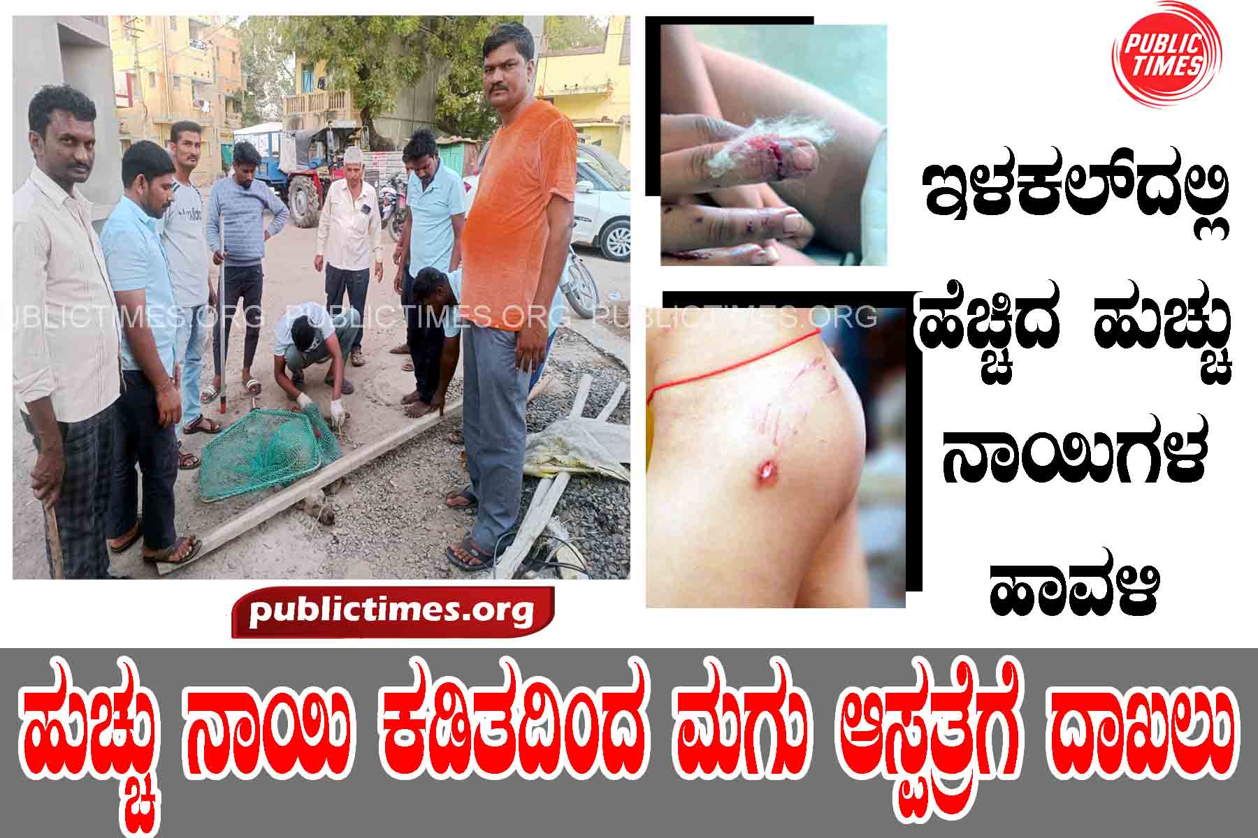 ILKAL Kid bitten by mad dog admitted to hospital ಹುಚ್ಚು ನಾಯಿ ಕಡಿತ ಮಗು ಆಸ್ಪತ್ರೆಗೆ ದಾಖಲು